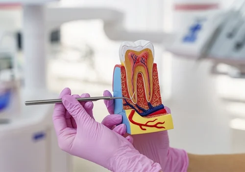 tratamento de canal dra odonto
